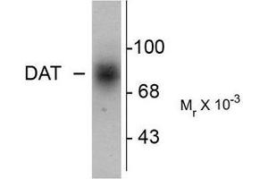 Image no. 1 for anti-Solute Carrier Family 6 (Neurotransmitter Transporter, Dopamine), Member 3 (SLC6A3) (C-Term) antibody (ABIN372613)