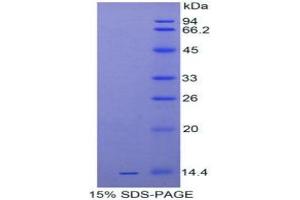 SDS-PAGE of Protein Standard from the Kit (Highly purified E. (IL-33 Kit CLIA)