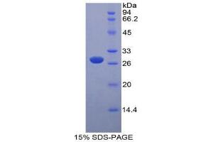 SDS-PAGE (SDS) image for Myosin Light Chain Kinase (MYLK) (AA 1684-1884) protein (His tag,GST tag) (ABIN2126006)