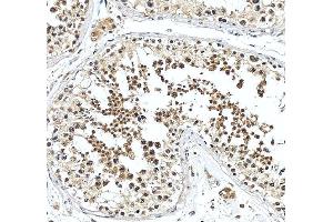 IHC analysis of SNUPN using anti-SNUPN antibody (ABIN7599310).