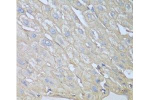 Immunohistochemistry of paraffin-embedded Human liver using RPH3AL Polyclonal Antibody at dilution of 1:100 (40x lens). (RPH3AL anticorps)