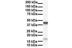 WB Suggested Anti-SMYD5 antibody Titration: 1 ug/mL Sample Type: Human HepG2 (SMYD5 anticorps  (C-Term))