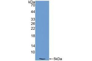 Detection of Recombinant EDN1, Human using Polyclonal Antibody to Endothelin 1 (EDN1)