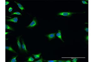 Immunofluorescence of purified MaxPab antibody to PDIA3 on HeLa cell.