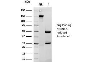 SDS-PAGE Analysis Purified Cytochrome C Mouse Monoclonal Antibody (rCYCS/1010).