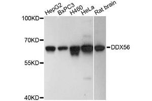 Western blot analysis of extracts of various cell lines, using DDX56 antibody (ABIN5996684) at 1:3000 dilution.
