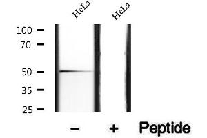 Western blot analysis of extracts of HeLa cells, using Phospho-IKK-gamma (Ser376) Antibody.