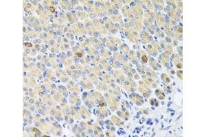 Immunohistochemistry of paraffin-embedded Mouse stomach using GLS Polyclonal Antibody at dilution of 1:100 (40x lens).
