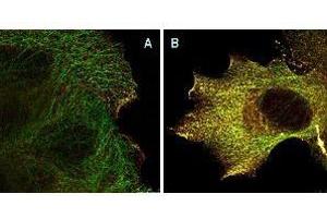 Immunofluorescence Microscopy of Mouse Anti-AKTpS473 antibody using STED nanoscopy to evaluate AKT activation and migration.