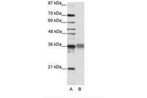 Image no. 2 for anti-T-Cell Leukemia Homeobox 2 (TLX2) (C-Term) antibody (ABIN202158) (TLX2 anticorps  (C-Term))