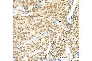 Immunohistochemistry of paraffin embedded human lymph node using MST1 (ABIN7075561) at dilution of 1: 1000 (400x lens)
