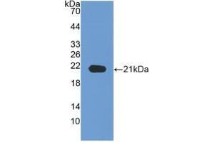 WB of Protein Standard: different control antibodies against Highly purified E. (Neuropilin 1 Kit ELISA)