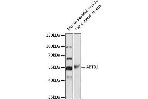 Western blot analysis of extracts of various cell lines, using  antibody  at 1:1000 dilution. (ABTB1 anticorps)