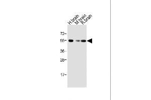 All lanes : Anti-Activin A Receptor Type IB (ACVR1B) Antibody (N-term) at 1:1000 dilution Lane 1: Human brain lysate Lane 2: Mouse brain lysate Lane 3: Rat brain lysate Lysates/proteins at 20 μg per lane.