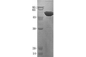 Validation with Western Blot