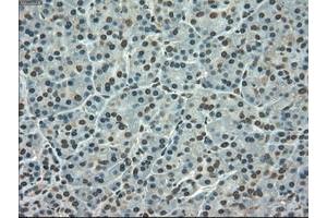 Immunohistochemistry (IHC) image for anti-Solute Carrier Family 7 (Amino Acid Transporter, L-Type), Member 8 (SLC7A8) antibody (ABIN1500960)