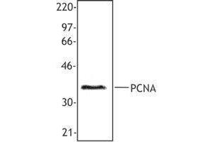 Western Blotting (WB) image for anti-Proliferating Cell Nuclear Antigen (PCNA) antibody (ABIN2665321) (PCNA anticorps)