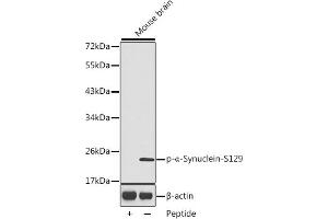 Western blot analysis of extracts from mouse brain tissue, using Phospho-α-Synuclein-S129 antibody (ABIN3020489, ABIN3020490, ABIN3020491 and ABIN1682058). (SNCA anticorps  (pSer129))