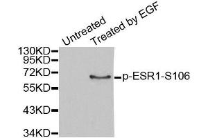 Western blot analysis of extracts from MCF7 cells, using Phospho-ESR1-S106 antibody (ABIN2988004). (Estrogen Receptor alpha anticorps  (pSer106))
