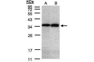 WB Image Sample(30 μg of whole cell lysate) A:HeLa S3, B:Hep G2, 12% SDS PAGE antibody diluted at 1:2000 (Annexin V anticorps)