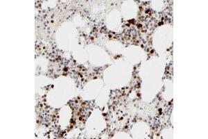 Immunohistochemical staining of human bone marrow with CDK6 polyclonal antibody  shows strong nuclear positivity in bone marrow poietic cells at 1:20-1:50 dilution. (CDK6 anticorps)