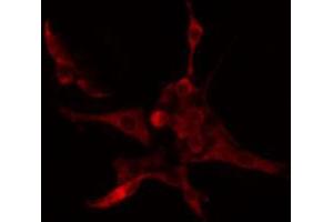 ABIN6274659 staining COLO205 cells by IF/ICC. (CYP4B1 anticorps  (Internal Region))