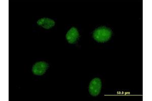 Immunofluorescence of purified MaxPab antibody to HGD on HeLa cell. (HGD anticorps  (AA 1-445))