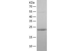 Western Blotting (WB) image for RAB3A, Member RAS Oncogene Family (RAB3A) (AA 1-220) protein (His-IF2DI Tag) (ABIN7124755)