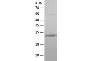 Western Blotting (WB) image for RAB3A, Member RAS Oncogene Family (RAB3A) (AA 1-220) protein (His tag) (ABIN7124755) (RAB3A Protein (AA 1-220) (His tag))