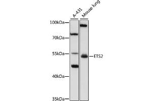 Western blot analysis of extracts of various cell lines, using SPRY3 antibody (ABIN6133259, ABIN6140325, ABIN6140326 and ABIN6223170) at 1:1000 dilution. (ETS2 anticorps  (AA 160-350))