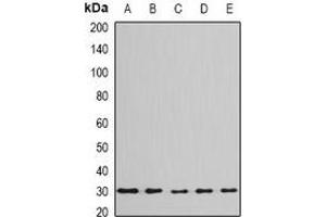 Western blot analysis of BPGM expression in Jurkat (A), Hela (B), mouse liver (C), mouse testis (D), rat brain (E) whole cell lysates.