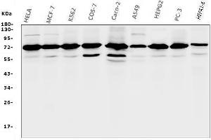 Western blot analysis of RPA70 using anti-RPA70 antibody (ABIN6719369).