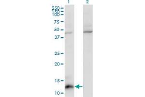 Western Blot analysis of CCL7 expression in transfected 293T cell line by CCL7 monoclonal antibody (M03), clone 4B5. (CCL7 anticorps  (AA 24-99))