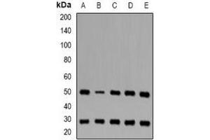 Western blot analysis of CD16b expression in Jurkat (A), THP1 (B), mouse liver (C), mouse thymus (D), rat spleen (E) whole cell lysates.
