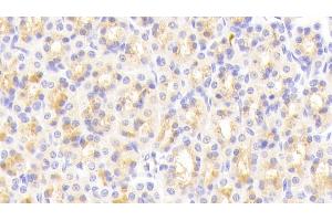 Detection of vWA1 in Rat Stomach Tissue using Polyclonal Antibody to Von Willebrand Factor A Domain Containing Protein 1 (vWA1)