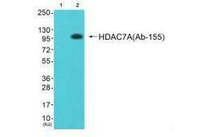 Western blot analysis of extracts from JK cells (Lane 2), using HDAC7A (Ab-155) antiobdy. (HDAC7 anticorps  (Ser155))