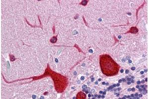 Human Brain, cerebellum: Formalin-Fixed, Paraffin-Embedded (FFPE)