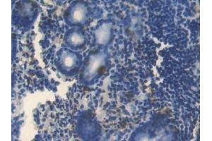 Detection of BMP4 in Human Stomach Tissue using Polyclonal Antibody to Bone Morphogenetic Protein 4 (BMP4) (BMP4 anticorps  (AA 22-408))