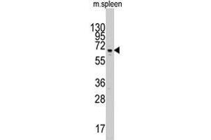 Western blot analysis of Parp3 polyclonal antibody  in mouse spleen tissue lysate (35 ug/lane).