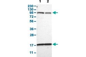 Western Blot analysis with DPP8 polyclonal antibody . (DPP8 anticorps  (AA 17-135))