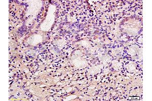 Formalin-fixed and paraffin embedded human gastric mucosa labeled with Anti-CA IX/CA9 Polyclonal Antibody, Unconjugated (ABIN752773) at 1:200 followed by conjugation to the secondary antibody and DAB staining. (CA9 anticorps  (AA 251-350))