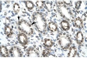 Immunohistochemistry (IHC) image for anti-Ha-Ry/enhancer-of-Split Related with YRPW Motif 1 (HEY1) (C-Term) antibody (ABIN2779686) (HEY1 anticorps  (C-Term))