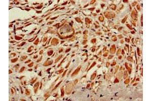 Immunohistochemistry of paraffin-embedded human placenta tissue using ABIN7168188 at dilution of 1:100 (MSK1 anticorps  (AA 224-367))