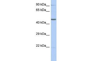 WB Suggested Anti-ZNF669 Antibody Titration:  0.