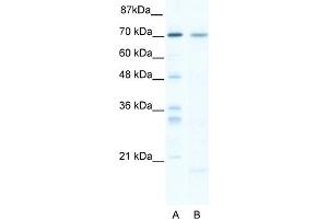 WB Suggested Anti-SOX13 Antibody Titration:  5. (SOX13 anticorps  (C-Term))