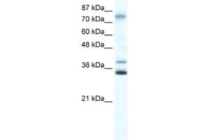 Western Blotting (WB) image for anti-Zinc Finger Protein 570 (ZNF570) antibody (ABIN2461299) (ZNF570 anticorps)