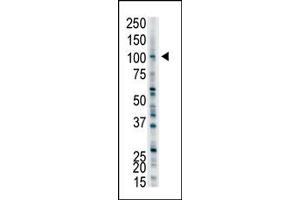 Image no. 1 for anti-Ubiquitin Protein Ligase E3A (ube3a) (C-Term) antibody (ABIN357571) (ube3a anticorps  (C-Term))