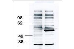 Western blot analysis of anti-BLK Pab (ABIN392087 and ABIN2841844) transiently transfected HEK-293 cell line lysate (1 μg/lane).