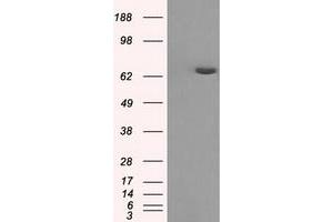 HEK293T cells were transfected with the pCMV6-ENTRY control (Left lane) or pCMV6-ENTRY HDAC10 (Right lane) cDNA for 48 hrs and lysed. (HDAC10 anticorps)