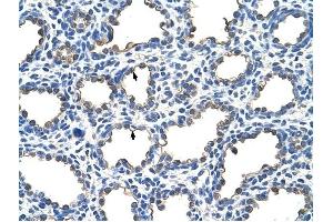 EMP2 antibody was used for immunohistochemistry at a concentration of 4-8 ug/ml to stain Alveolar cells (arrows) in Human Lung. (EMP2 anticorps  (Middle Region))